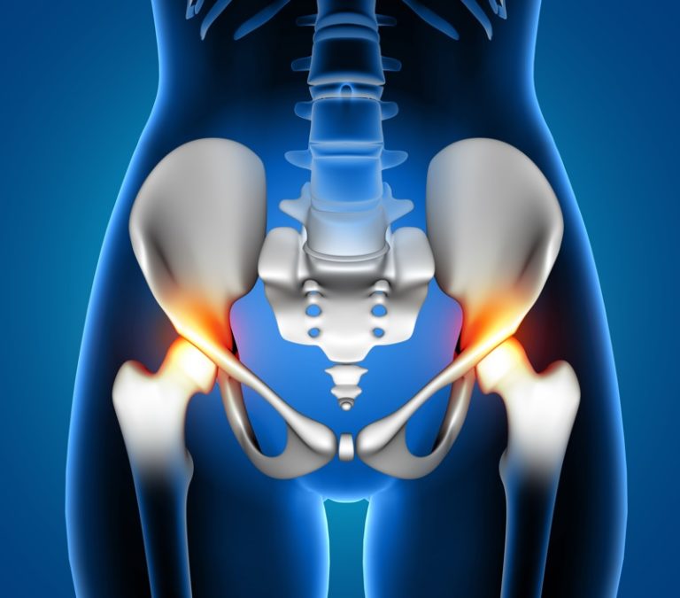 Hip Pain Treatment in Knoxville | Knoxville Spine & Sports